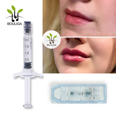 remplisseur lié croisé monophasique d'acide hyaluronique de remplisseur cutané des lèvres 2ml pour la lèvre