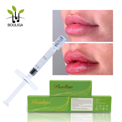 Élargissement réticulé cosmétique de lèvre de remplisseur d'acide hyaluronique injectable